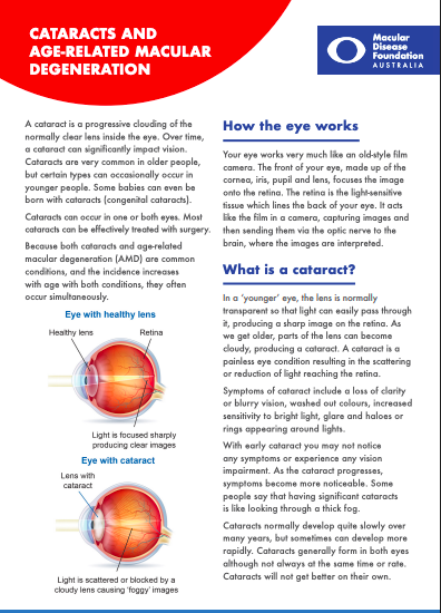 Cataracts and AMD